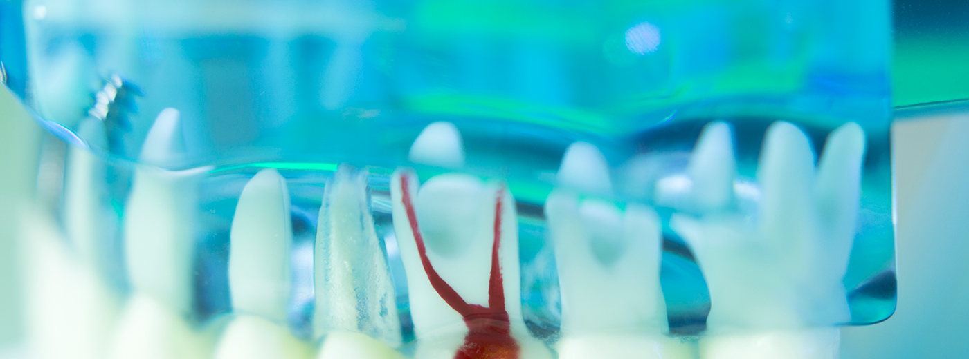 Erfolgreiche Endodontie: Ein Konzept für die Praxis!